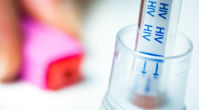 UK projects shows emergency department testing can uncover undiagnosed HIV